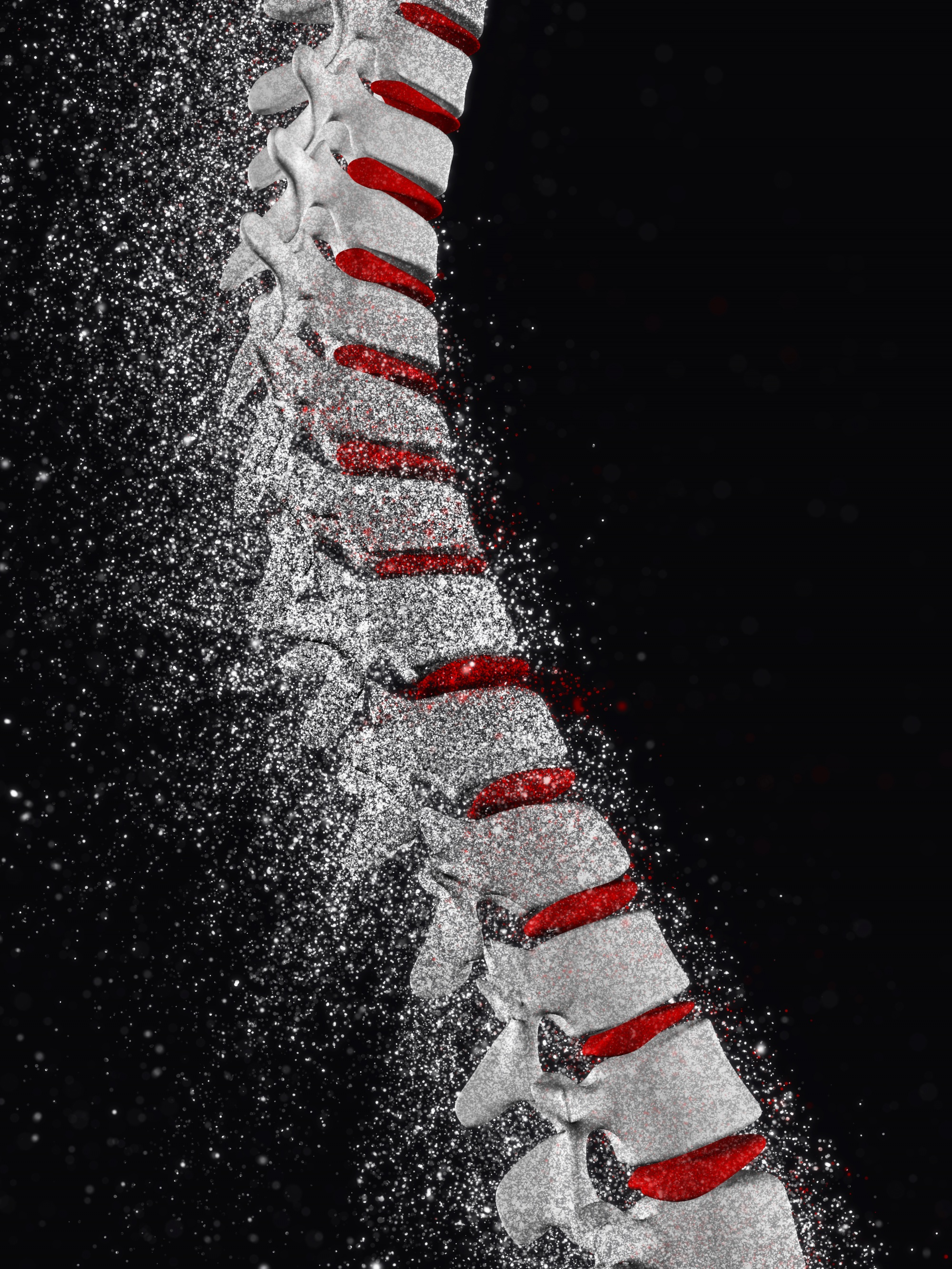 Osteoporosi e dolore